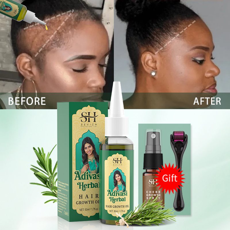 น้ำมันบำรุงผมอายุรเวทจากอินเดี - Hair Care Essence Oil Spray บทวิจารณ์และราคา