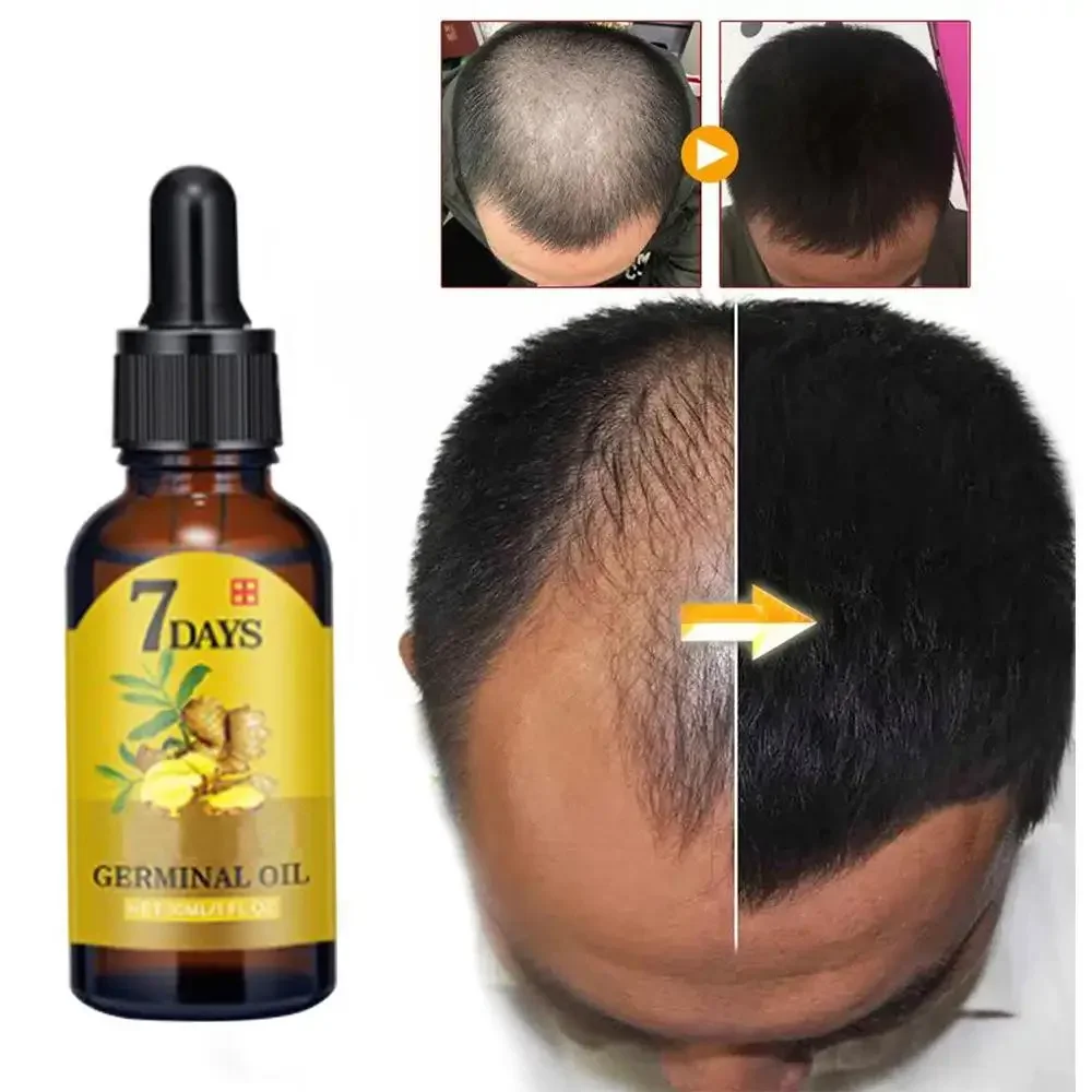 Hair Growth Ginger Fast Growin - Hair Care Essence Oil Spray บทวิจารณ์และราคา